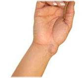 Wrist Wrist