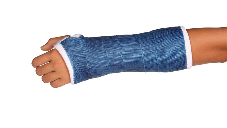 Wrist with fracture in a blue cast. Learning about wrist fracture treatments with Ladan Hajipour