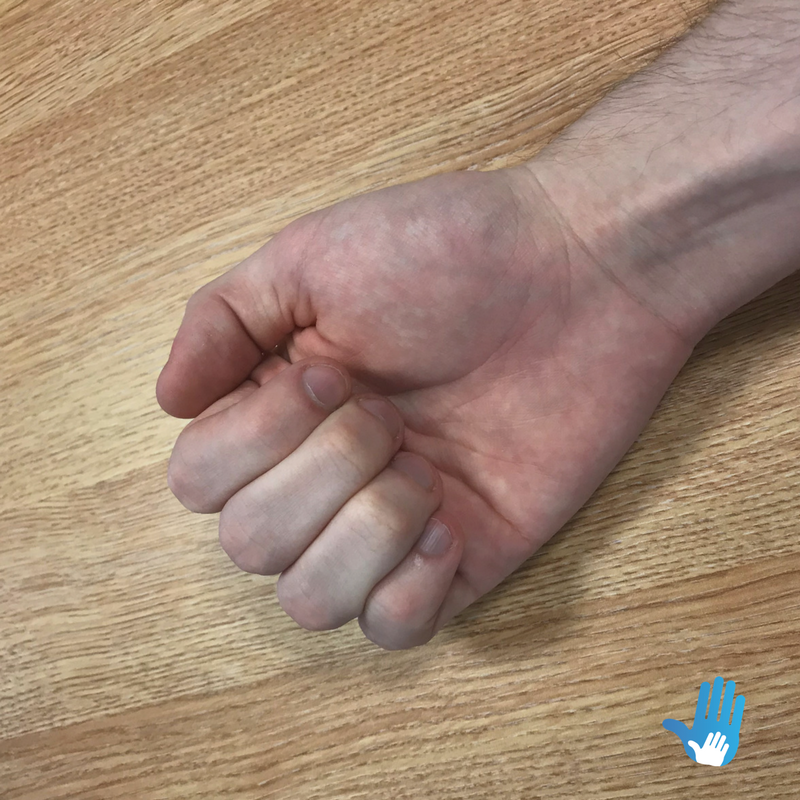 fist ball exercise for osteoarthritis