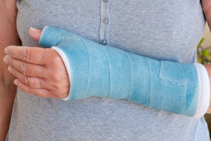 broken wrist in a cast