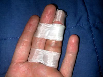 broken finger wrist splint